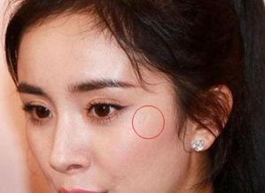 女明星疤痕,女明星疤痕的美丽蜕变