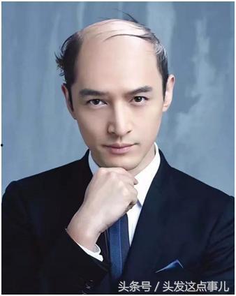 秃顶明星有谁,盘点那些勇敢秀出真我魅力的明星