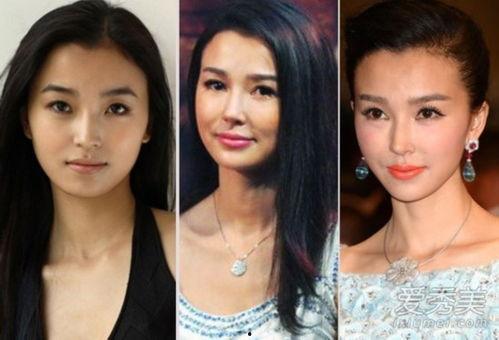 明星整容的多吗